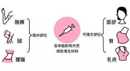 腿再瘦一點(diǎn)？腰再細(xì)一點(diǎn)？胸再大一點(diǎn)？自體脂肪填充，一步到位！
