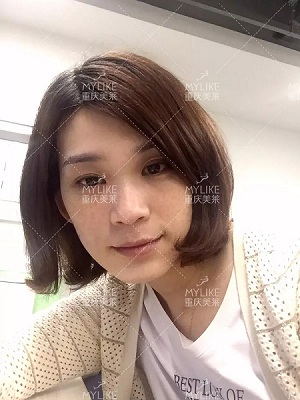 那個(gè)斑點(diǎn)女孩后來(lái)怎么樣了？