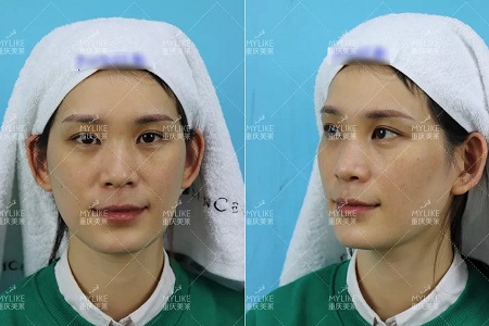 那個(gè)斑點(diǎn)女孩后來(lái)怎么樣了？