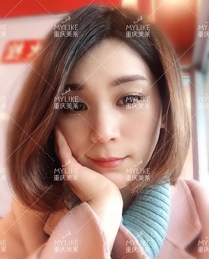 那個(gè)斑點(diǎn)女孩后來(lái)怎么樣了？