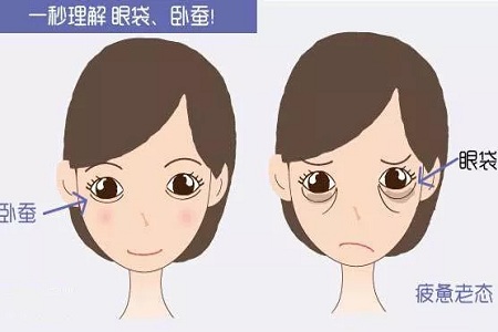 美萊實(shí)驗(yàn)室：分型祛除眼袋，拒絕+10歲