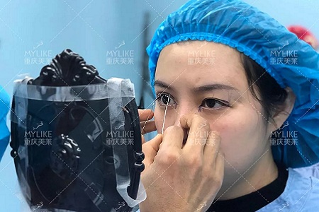 大小眼、不對稱，你是長胖了還是真老了？