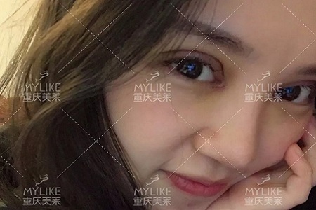 大小眼、不對稱，你是長胖了還是真老了？