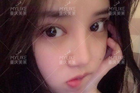 大小眼、不對稱，你是長胖了還是真老了？