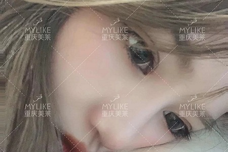 大小眼、不對稱，你是長胖了還是真老了？