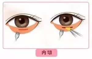 每到放假，做這個(gè)項(xiàng)目的人就會增多！--眼袋