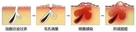 如何在炎熱的夏天，做清爽白凈的小姐姐？