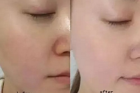 如何在炎熱的夏天，做清爽白凈的小姐姐？