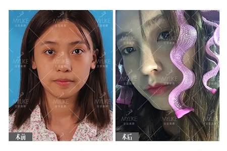 顏值：鼻子一小步，顏值一大步~