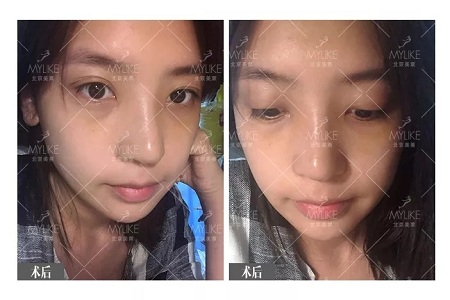 顏值：鼻子一小步，顏值一大步~
