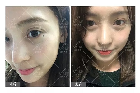 顏值：鼻子一小步，顏值一大步~