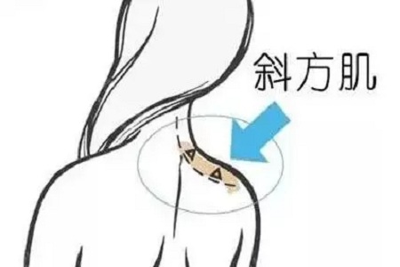 成功減肥20斤為什么還被吐槽又老又丑？