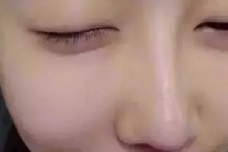水光，打1次和4次究竟有多大區(qū)別？