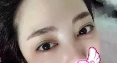 水光，打1次和4次究竟有多大區(qū)別？