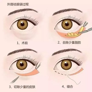 還把眼袋當(dāng)臥蠶？那就別怪小弟弟喊你阿姨了