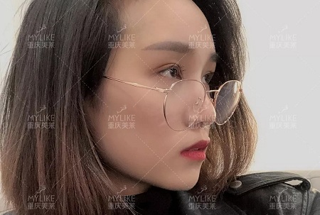 自體脂肪+雙眼皮，這對(duì)cp你不pick一下嗎？