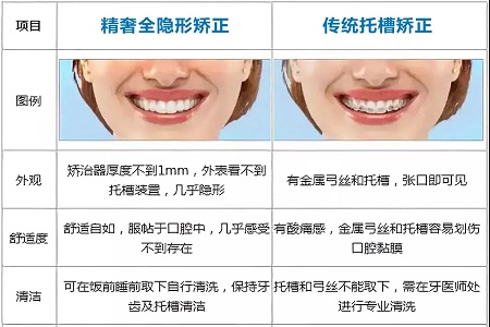 這種牙齒矯正方式，96%的人都會(huì)選擇！