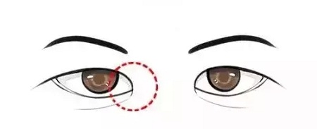 美萊實(shí)驗(yàn)室：開(kāi)眼角就是醫(yī)師想多收錢(qián)？