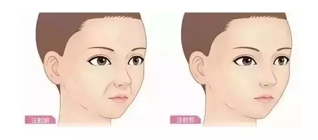 問(wèn)診室：你說(shuō)脂肪壓得你好累，殊不知它也可以是寶貝