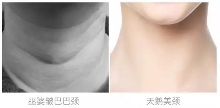 悄咪咪的年輕十歲，撫平頸紋一起“嗨”