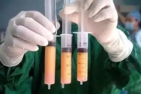 顯老淚溝，你還要任其放肆嗎？
