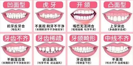 有效數(shù)據(jù)生成，預(yù)見牙齒矯正后的自己
