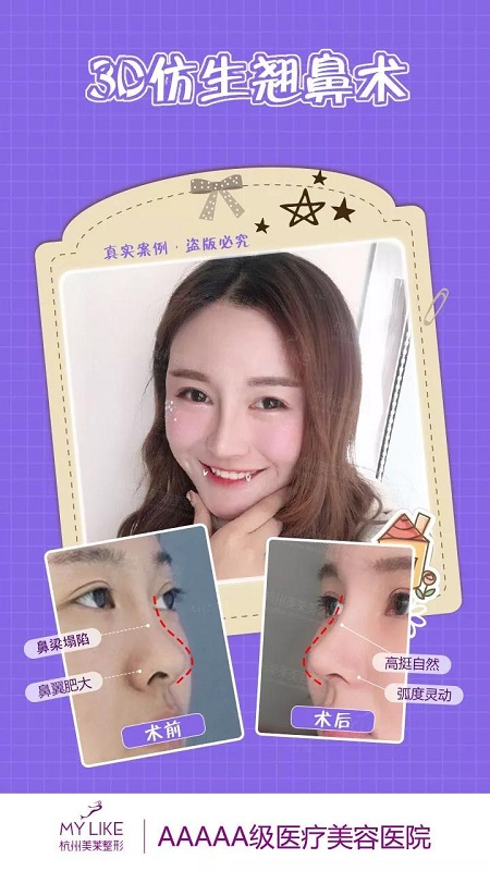 CURE全度美眸，仿生3D翹鼻，想美哪里你來定