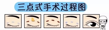 美眼張誠坐診美萊，淺談為什么你的眼睛不夠美？