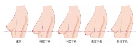 一味追求大胸的她們，卻忽略了這個問題...