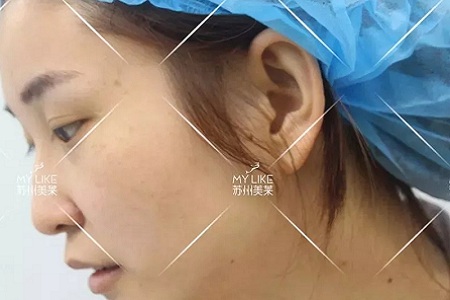 鼻子不是越高越好看！