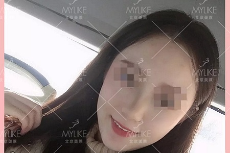 顏值日志 | 鼻子對整體顏值的改變有多大？
