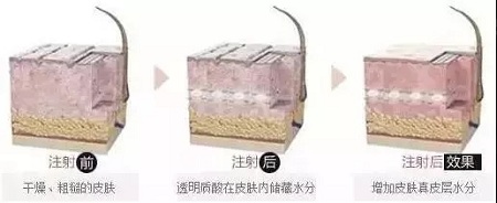 水光迎夏，“針”美麗