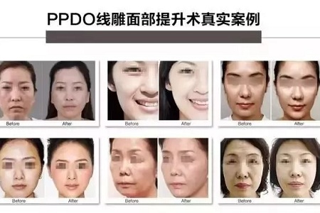 關(guān)于*雕，你想了解的都在這里！