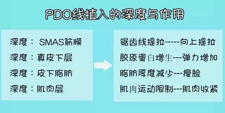 關(guān)于*雕，你想了解的都在這里！