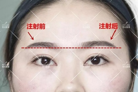 想要?dú)W式大眼，一定要注意與這個(gè)部位協(xié)調(diào)！