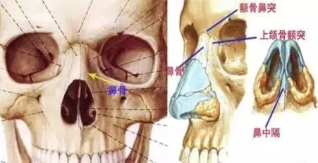 側(cè)面看鼻梁不矮,正面看鼻子卻很塌是什么原因？