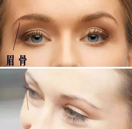 全切？埋線？韓式三點雙眼皮？選擇那種比較好？