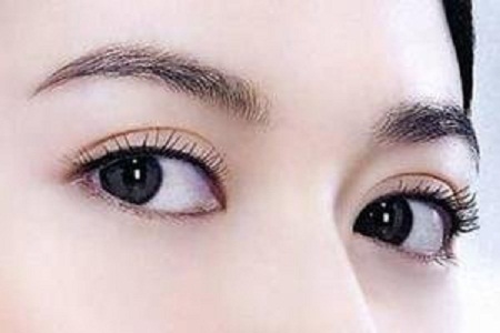 ?雙眼皮手術(shù)只聽(tīng)過(guò)全切？還有哪些眼部手術(shù)方法？