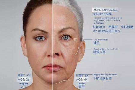 皺紋、松垂、凹陷，三大衰老癥狀，怎么解決？