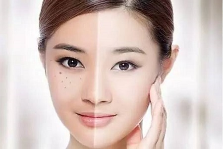 激光美白嫩膚多少錢(qián)