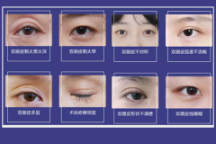 鄭州美萊雙眼皮修復為什么比割雙眼皮貴？