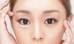 深圳美萊祛除眼袋的更好辦法是什么？