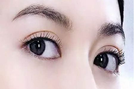 衡陽眼部抽脂價(jià)格 解決你的天生腫眼泡