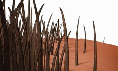 發(fā)際線后移做植發(fā)手術(shù)有用嗎，需要多少錢