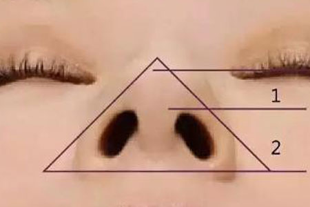 鼻頭大做手術(shù)縮小需要多少錢，手術(shù)安全嗎？