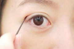 重慶割雙眼皮醫(yī)院手術(shù)多少錢，多久能恢復正常
